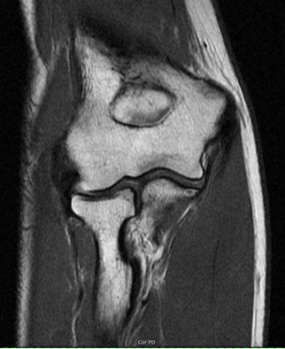 Musculoskeletal MRI Exams Elbow 