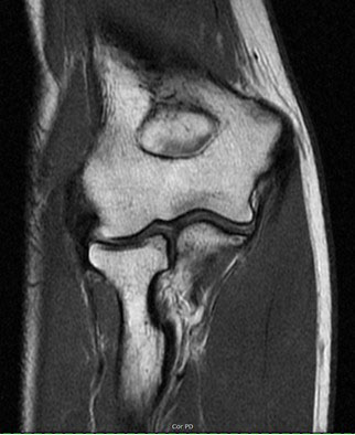 Musculoskeletal MRI Exams Elbow