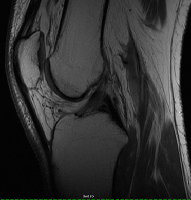 Musculoskeletal MRI Exams Knee