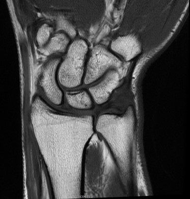 Musculoskeletal MRI Exams Wrist